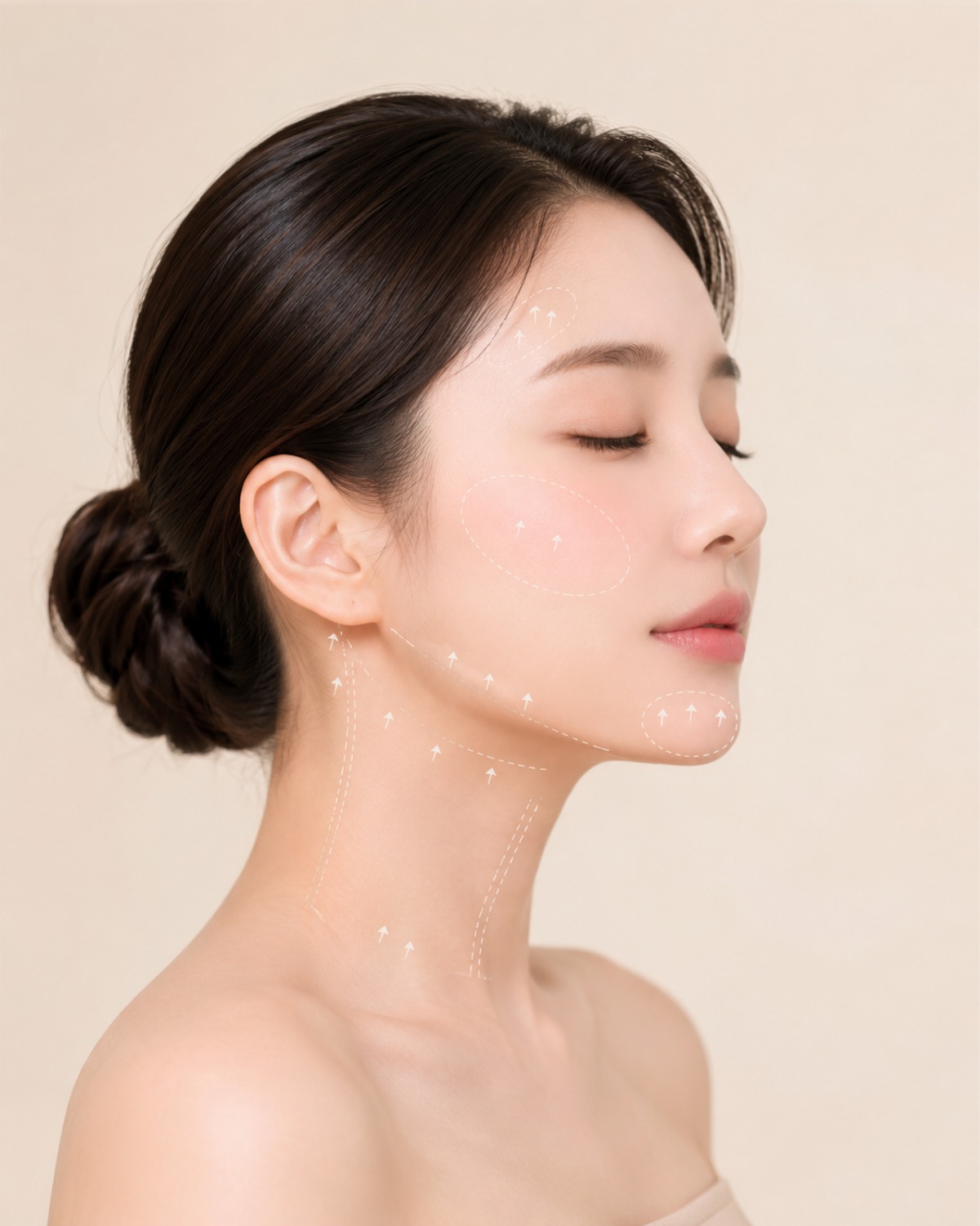 여드름 흉터 이미지